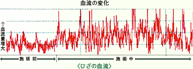 ひざの血流