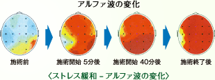 ストレス解消